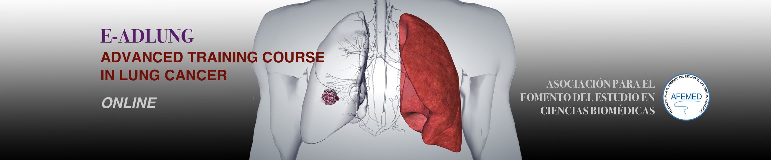 2nd advanced training course in lung cancer
